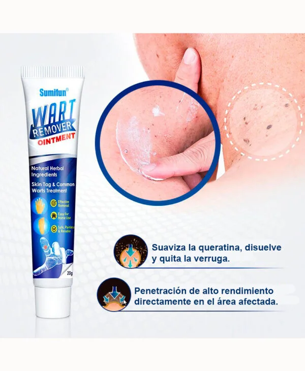 Crema para Verrugas WART